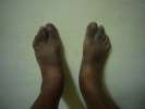 c est pas le pied, effet secondaire des medicaments
